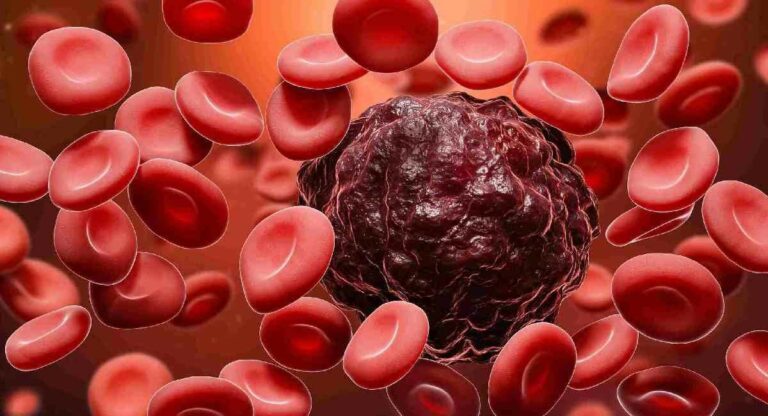 Blood Cancer च्या सुरूवातीला दिसणारे ‘हे’ एक साधे पण महाभयंकर लक्षण तोंडपाठ कराच
